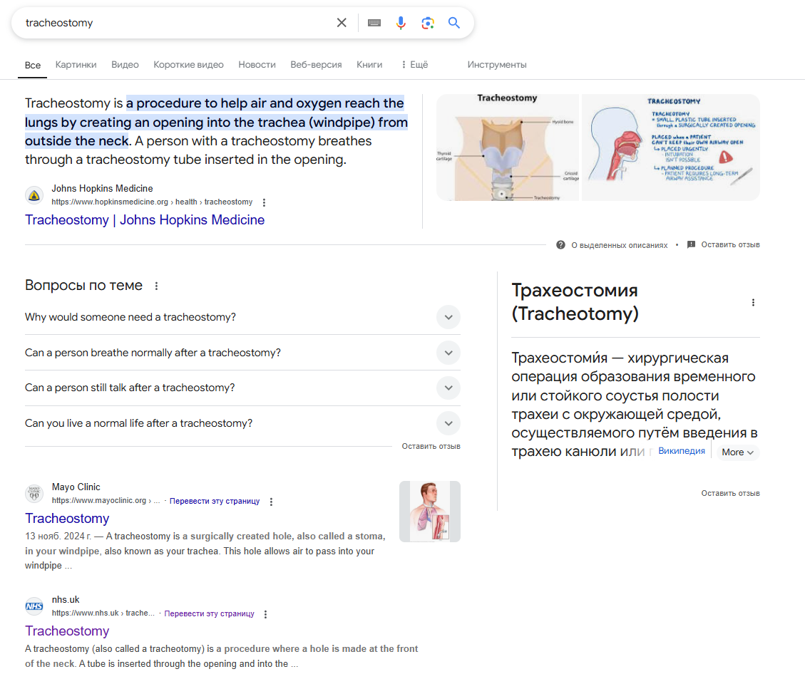 Яндекс и Google: сравнение основных факторов ранжирования