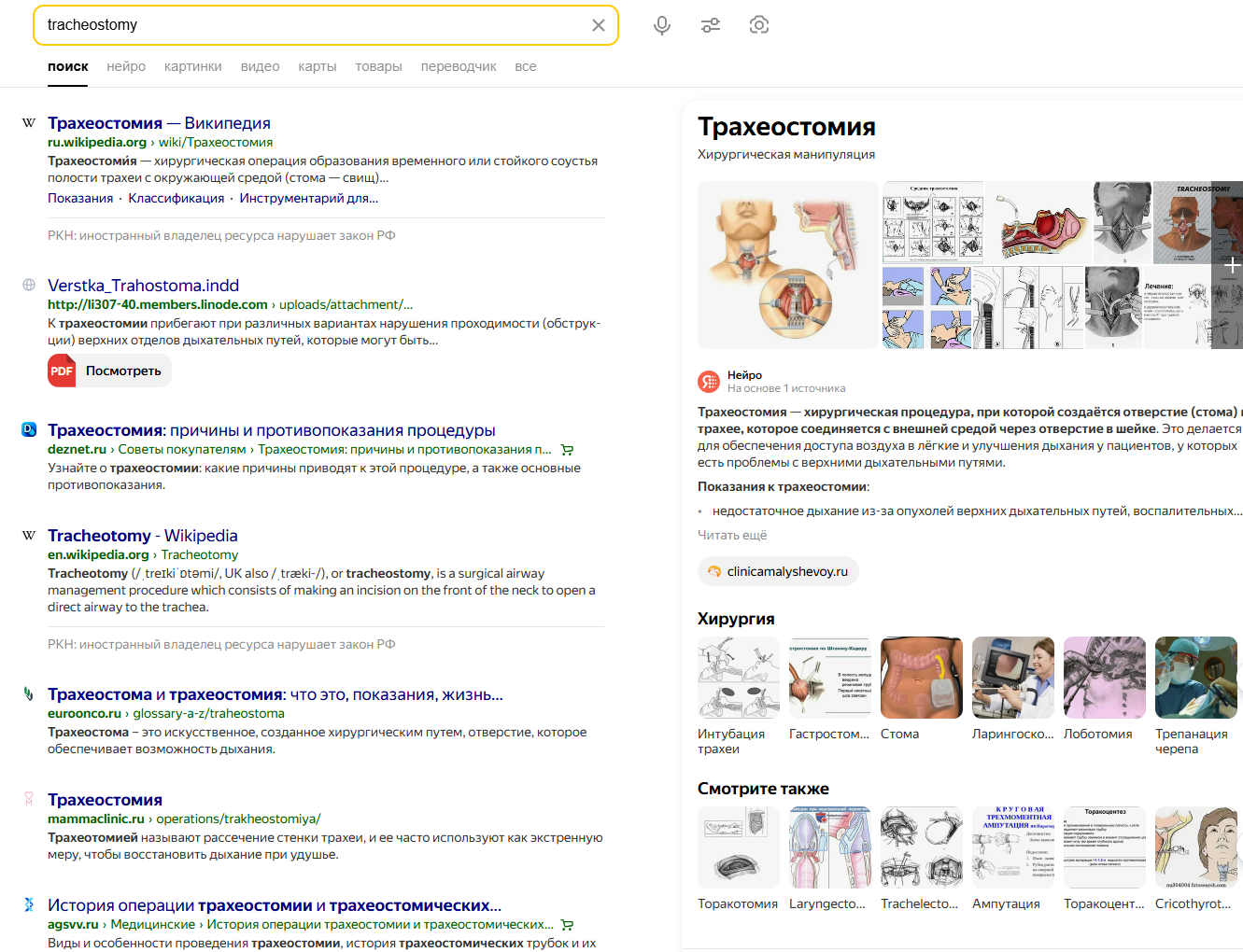 Яндекс и Google: сравнение основных факторов ранжирования - 1